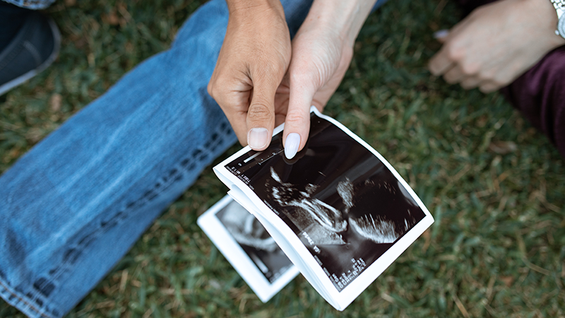 Som jordmor og universitetslektor ved Ultralydutdanning for jordmødre ved NTNU, er det derfor helt uforståelig at en ultralydundersøkelse tidlig i svangerskapet skal defineres som fosterdiagnostikk, mens undersøkelsen som gjøres ved 18 uker - ikke blir det.